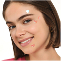 Essence pimple patches spot squad HOLO 10, 24pcs